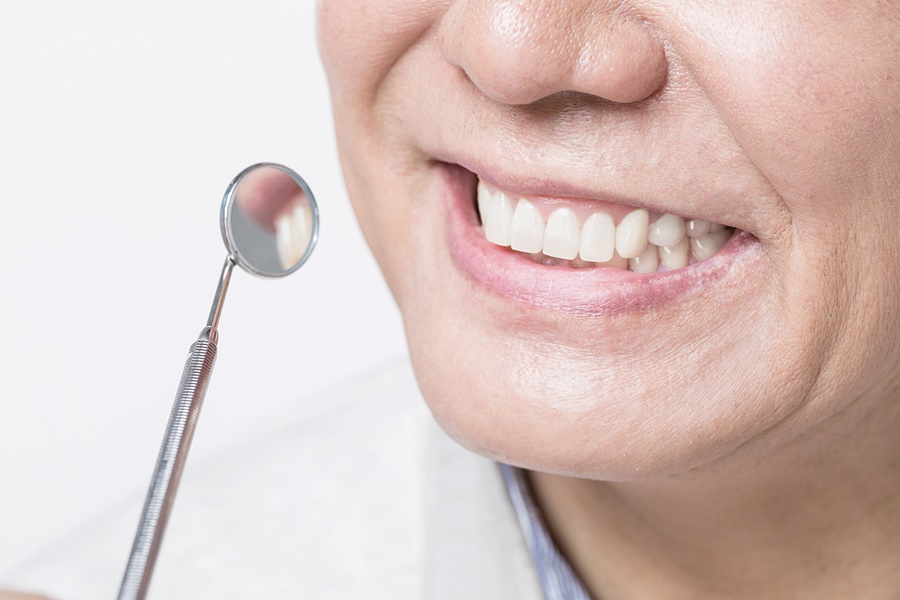 임플란트 정기검진 꼭 받아야 할까요 관련 이미지 4