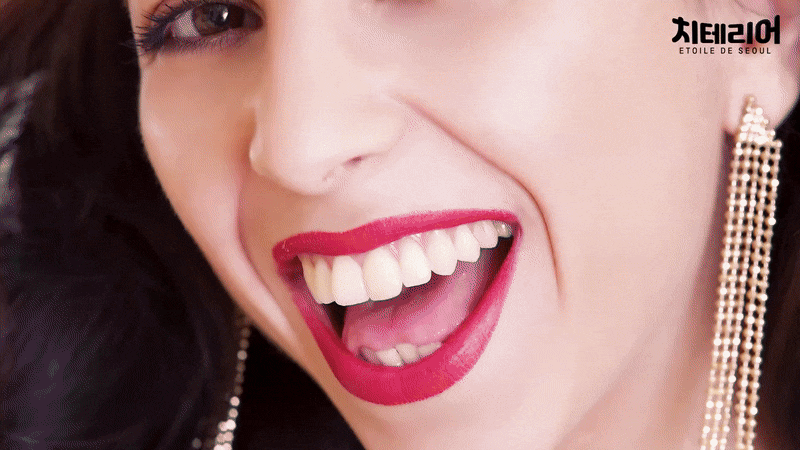 아랫니 라미네이트 숨겨왔던 미소를 되찾는 여정 관련 이미지 7