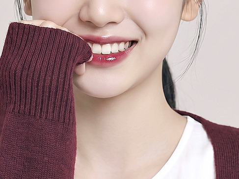 앞니 라미네이트 가격은 왜 치과마다 다를까 관련 이미지 3