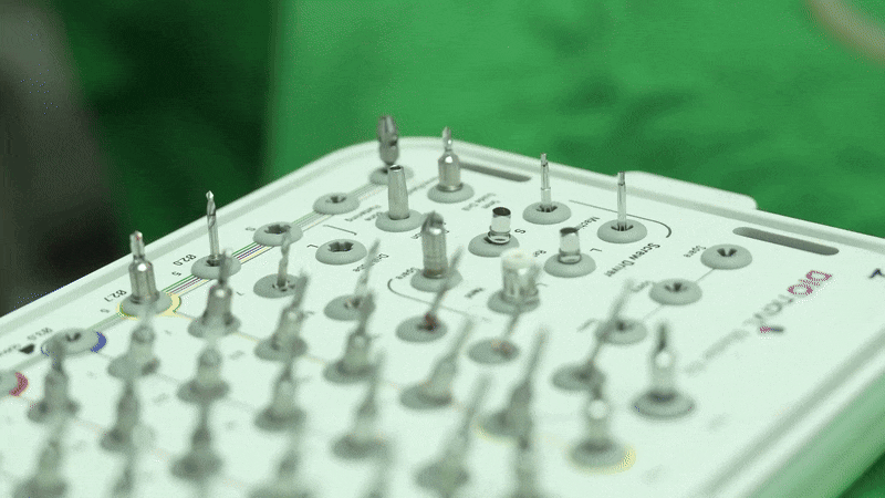 최소 삭제 라미네이트 치아를 지키며 아름다움 더하기 관련 이미지 6