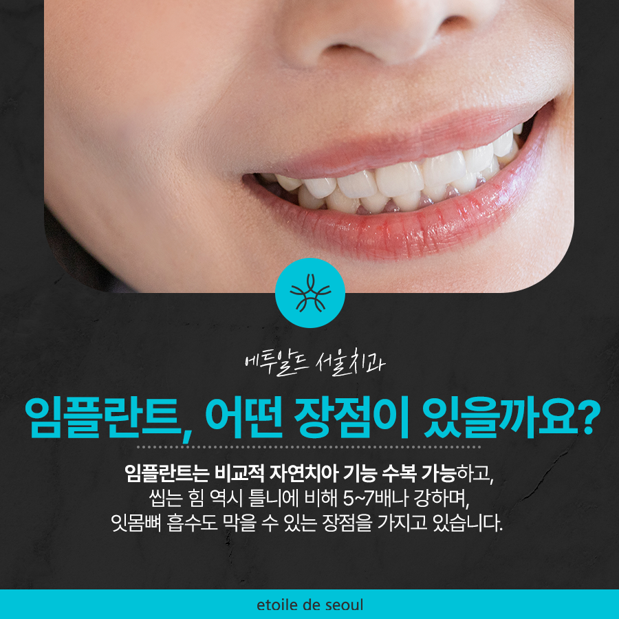 압구정로데오역 치과 불편한 틀니 대신 풀아치 임플란트! 관련 이미지 3