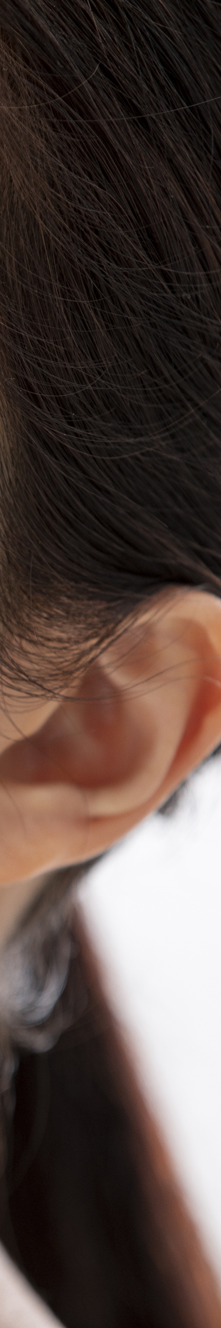 전체임플란트잘하는곳 치아 고민 끝에 만난 새로운 시작 관련 이미지 20