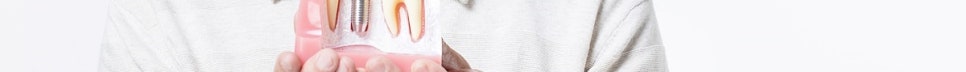 What Should You Choose for Denture Replacement Implants? image 47