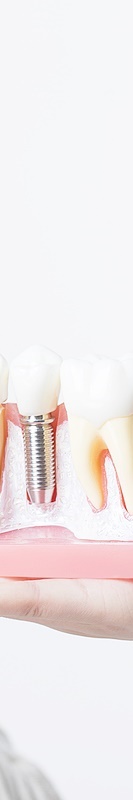 임플란트 수명을 위해 관리하는 방법 관련 이미지 38