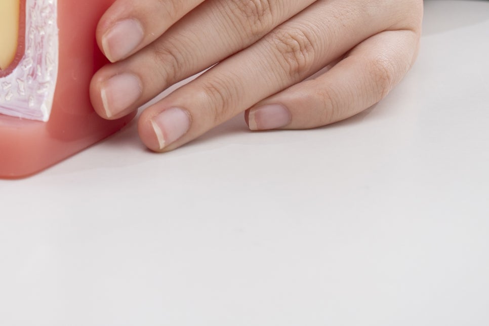 청담 임플란트 치과 미룰수록 독이에요! 관련 이미지 17