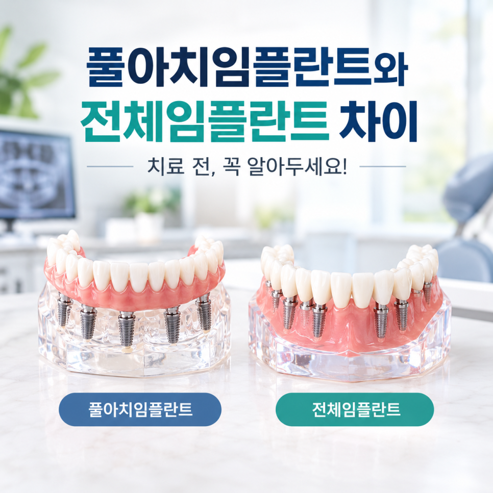 풀아치임플란트와 전체임플란트 차이, 치료 전 알아둘 점 관련 이미지 1