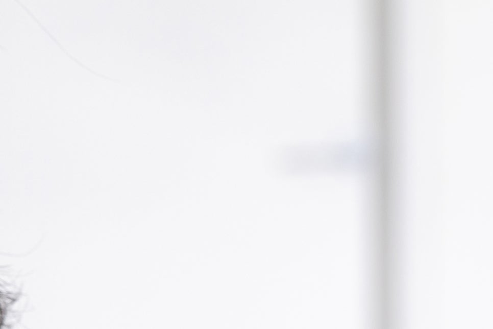 풀아치임플란트 비용 주의사항도 익혀보기 관련 이미지 14