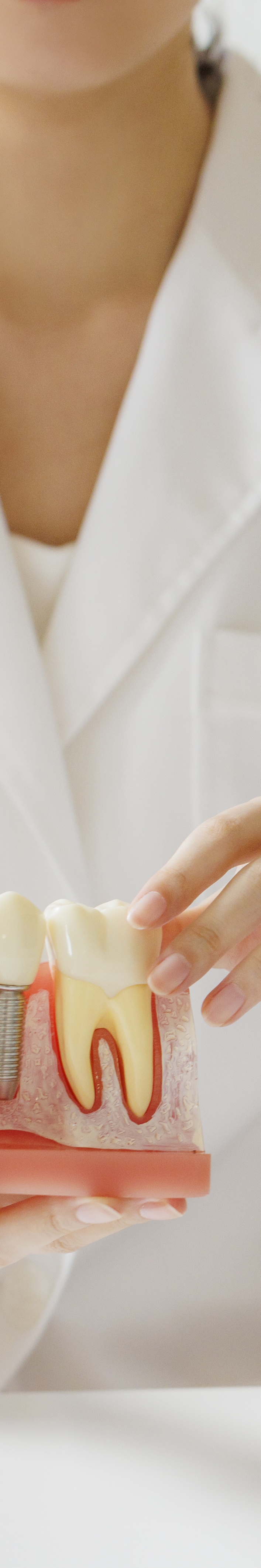 임플란트 임시틀니 빠졌을 때 당황하지 말고 이것부터 관련 이미지 31