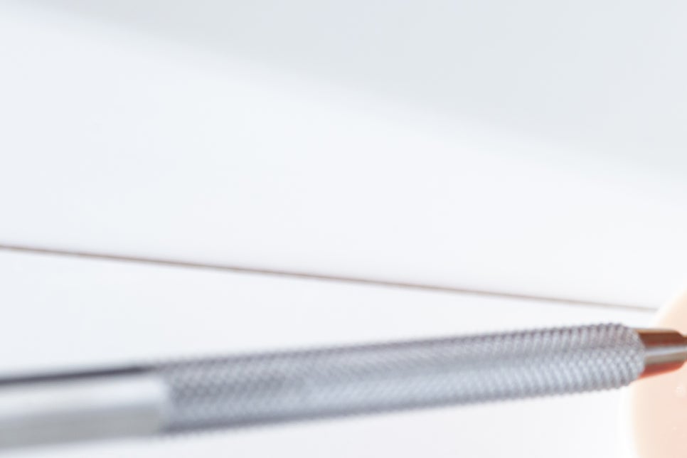 강남 어금니 임플란트 고려가 필요한 4가지! 관련 이미지 12