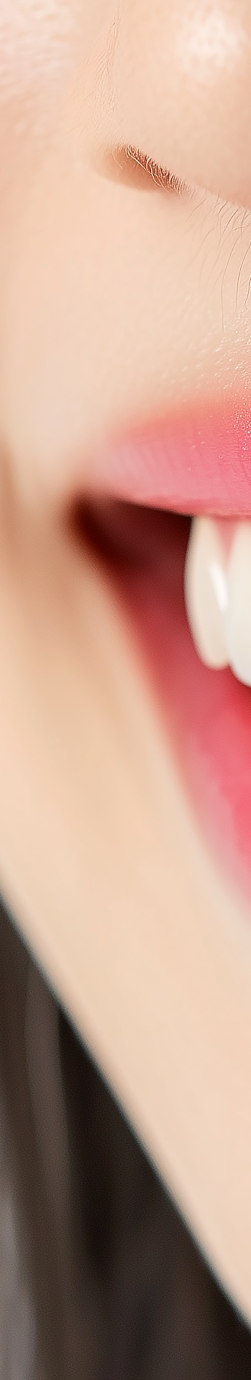 서울무삭제라미네이트 치아 본연의 아름다움을 지키다 관련 이미지 17