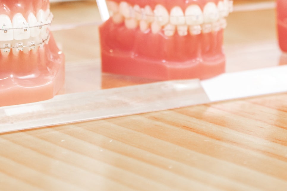 풀아치임플란트 잘하는곳 다수 식립 비용이 부담이라면 관련 이미지 26