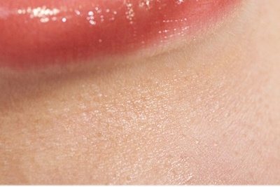 청담동치과 추천 앞니가 부러졌어요! 관련 이미지 26