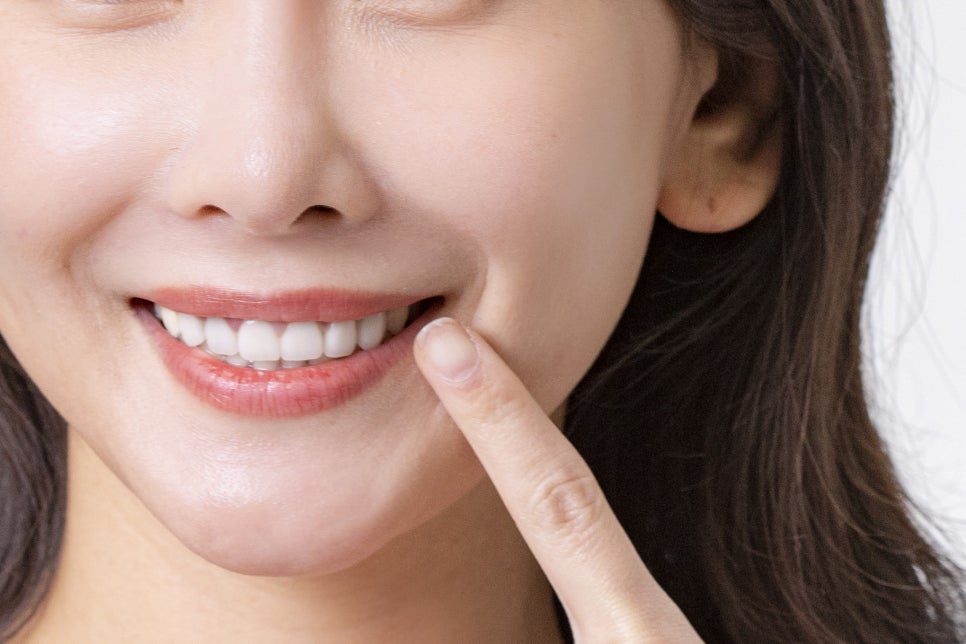 풀아치임플란트 비용 주의사항도 익혀보기 관련 이미지 13