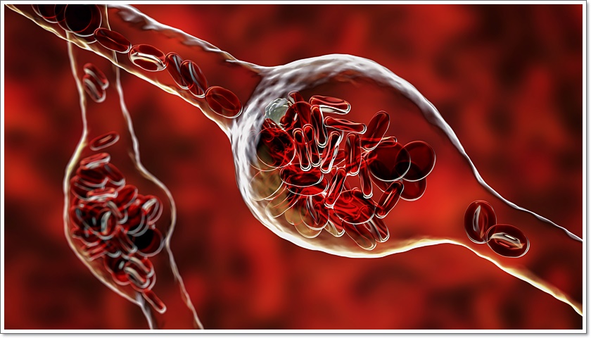 성인 혈압정상수치 범위 벗어나기 관련 이미지 6