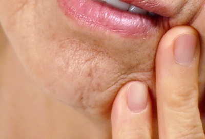 압구정로데오 임플란트 탄탄한 치아 유지는? 관련 이미지 13