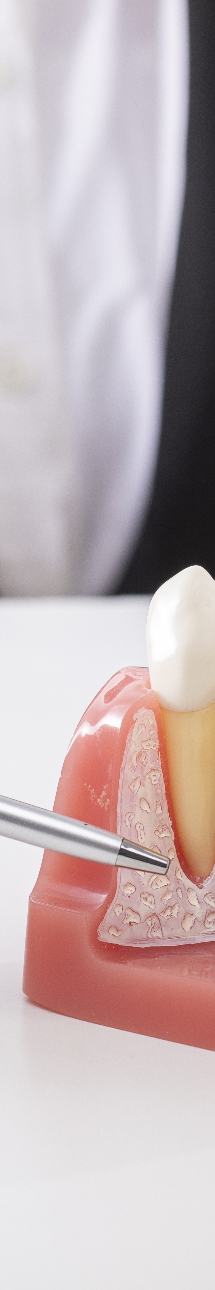 상악동거상술 윗턱 뼈 부족할 때 준비 과정은 관련 이미지 32