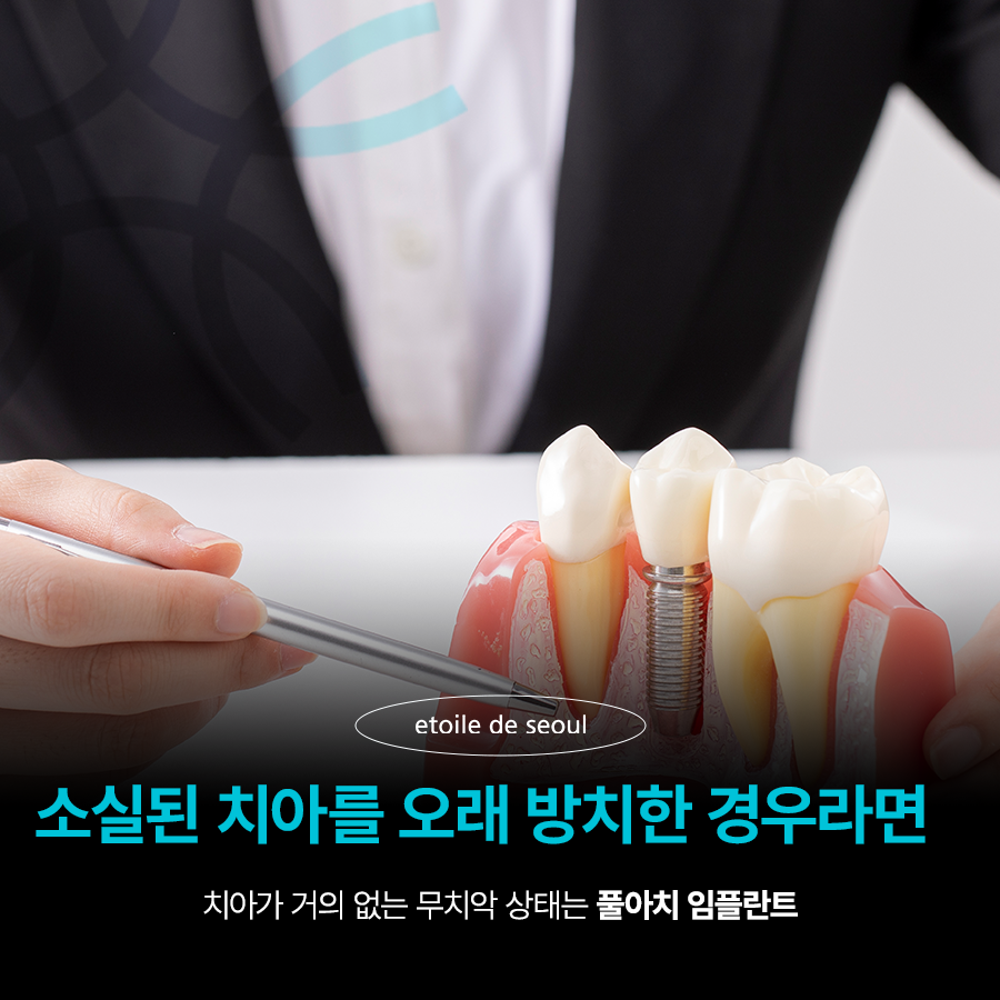 청담 임플란트 치과 미룰수록 독이에요! 관련 이미지 3