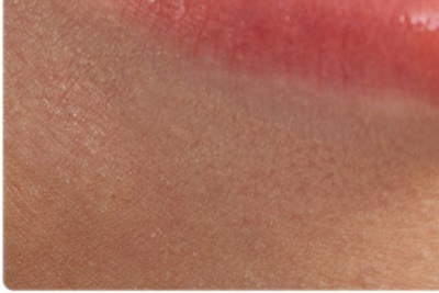 청담동치과 추천 앞니가 부러졌어요! 관련 이미지 25