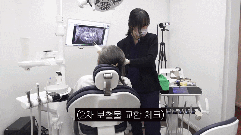 풀아치 임플란트 수술 시간 얼마나 걸릴까? 관련 이미지 14