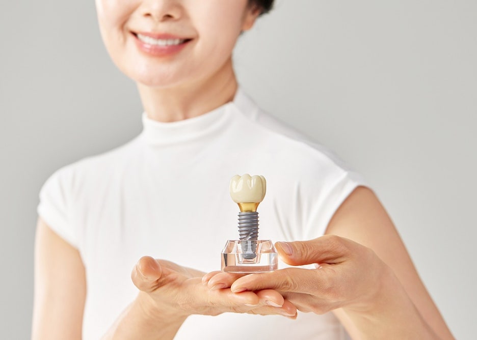 임플란트종류 장단점 확인해야 관련 이미지 10