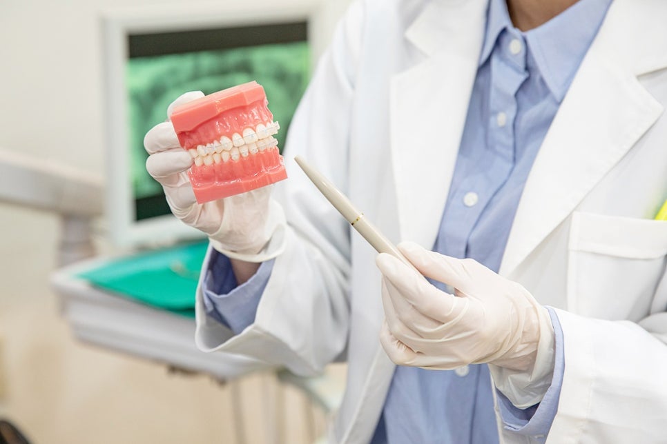 전악임플란트 저작력 되살리는 방법 관련 이미지 8