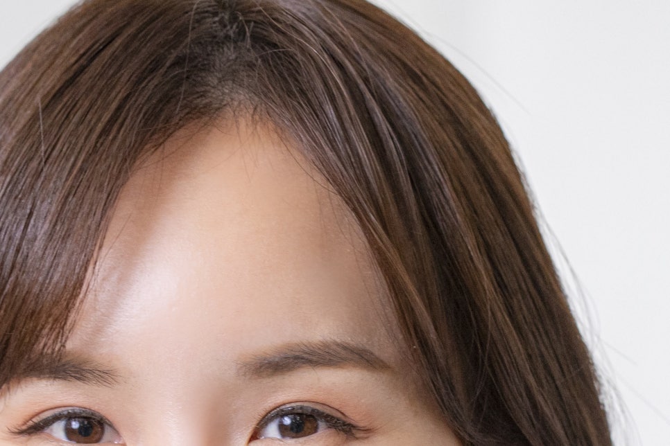 풀아치임플란트 비용 주의사항도 익혀보기 관련 이미지 10