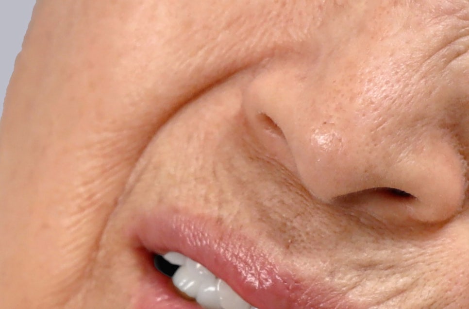 강남 어금니 임플란트 고려가 필요한 4가지! 관련 이미지 19