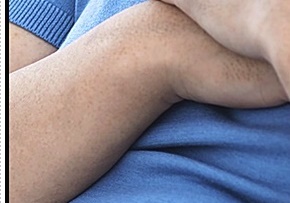 슬픈젖꼭지 증후군 진짜 있을까요? 관련 이미지 10