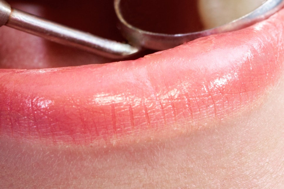 학동사거리 전악임플란트 치과 선택 시 이건 알아두자 관련 이미지 17