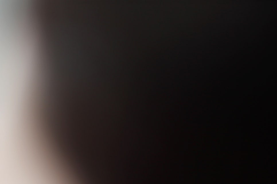 풀아치임플란트 비용 주의사항도 익혀보기 관련 이미지 20