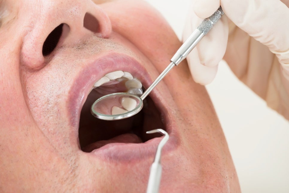 임플란트 수명을 위해 관리하는 방법 관련 이미지 8