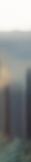 노본아치 임플란트 뼈이식없는 방식 관련 이미지 32