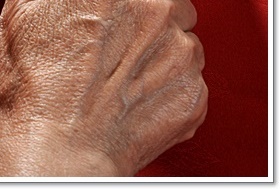 성인 혈압정상수치 범위 벗어나기 관련 이미지 15