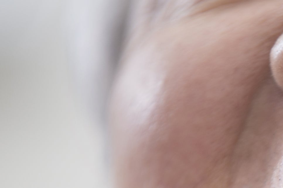 청담동 임플란트 불편함을 줄인 방법 관련 이미지 18