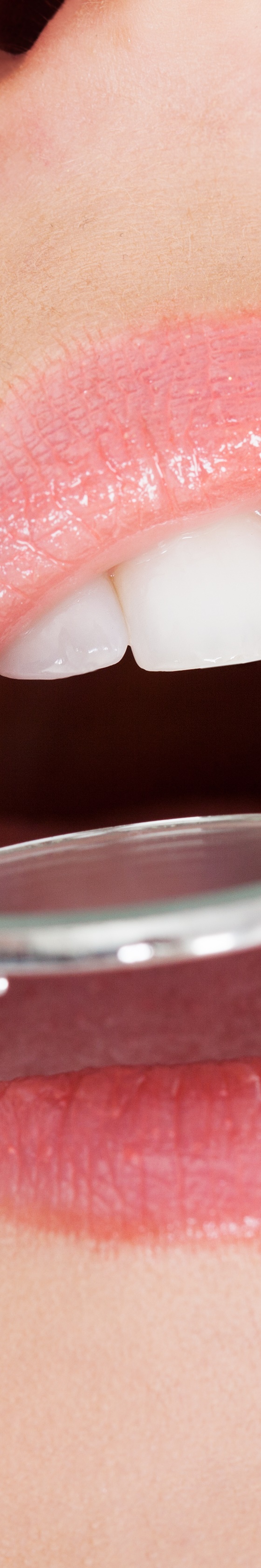 신사동임플란트 건강한 치아로 돌아가는 첫걸음 관련 이미지 27