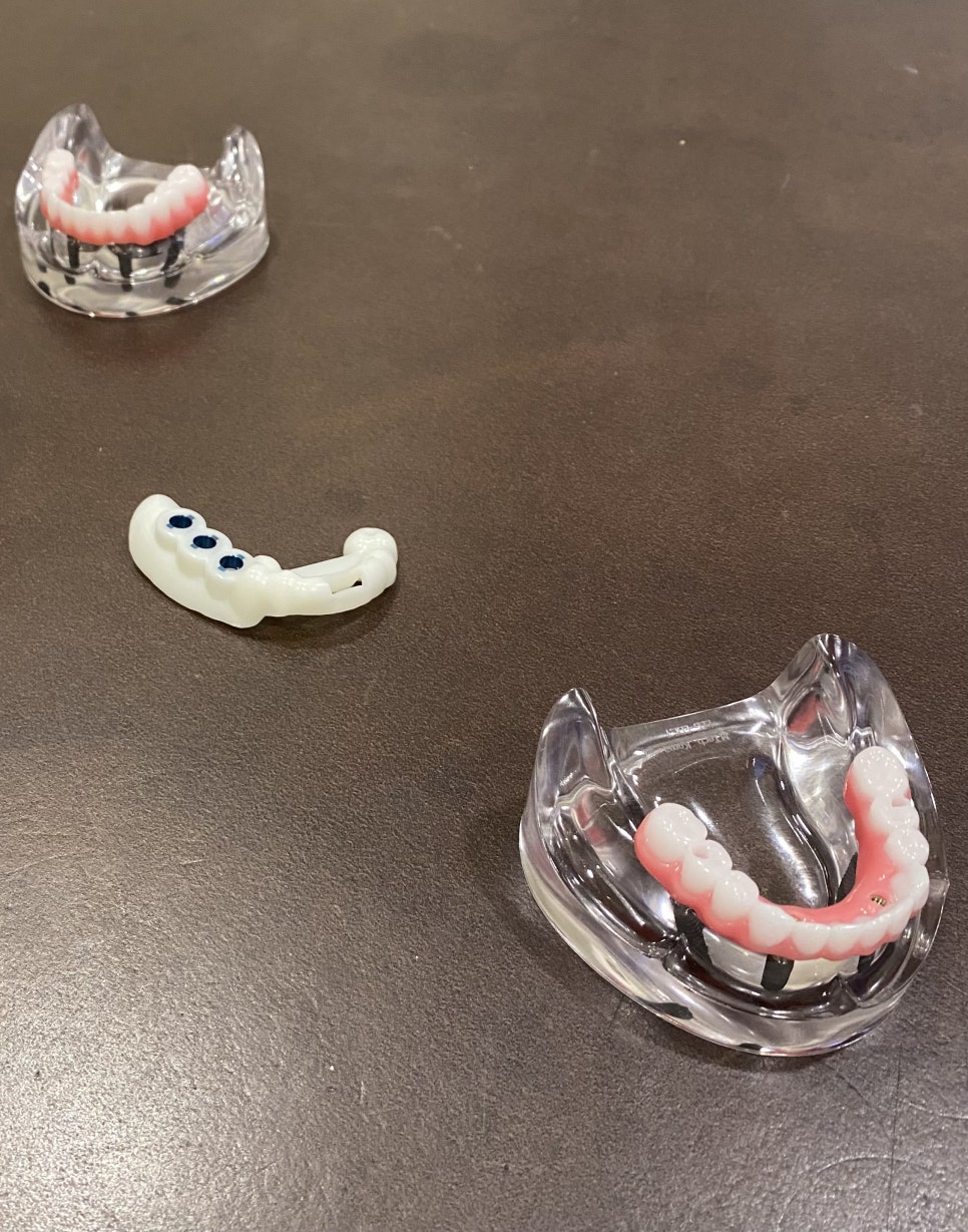 고령자임플란트비용 부담 덜어내는 방법 관련 이미지 5