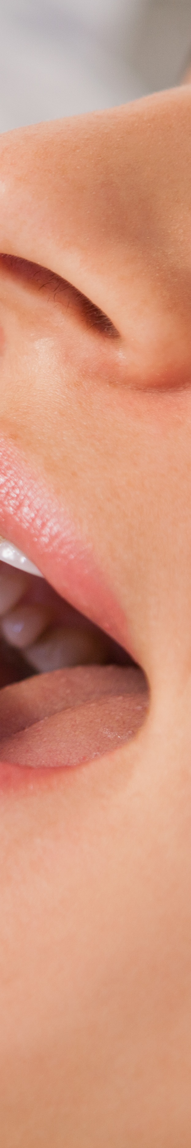 최소 삭제 라미네이트 치아를 지키며 아름다움 더하기 관련 이미지 30