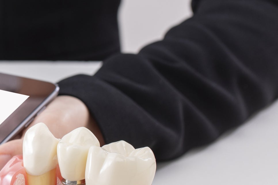 풀아치임플란트 잘하는곳 다수 식립 비용이 부담이라면 관련 이미지 15