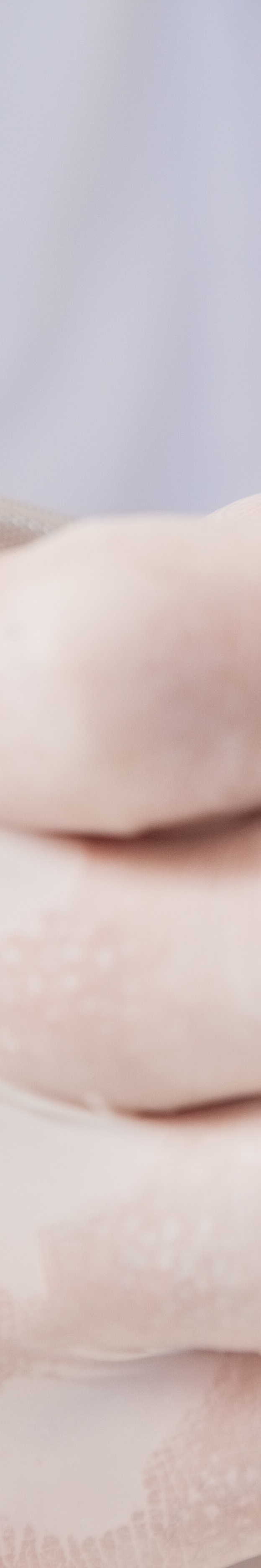 최소 삭제 라미네이트 치아를 지키며 아름다움 더하기 관련 이미지 25