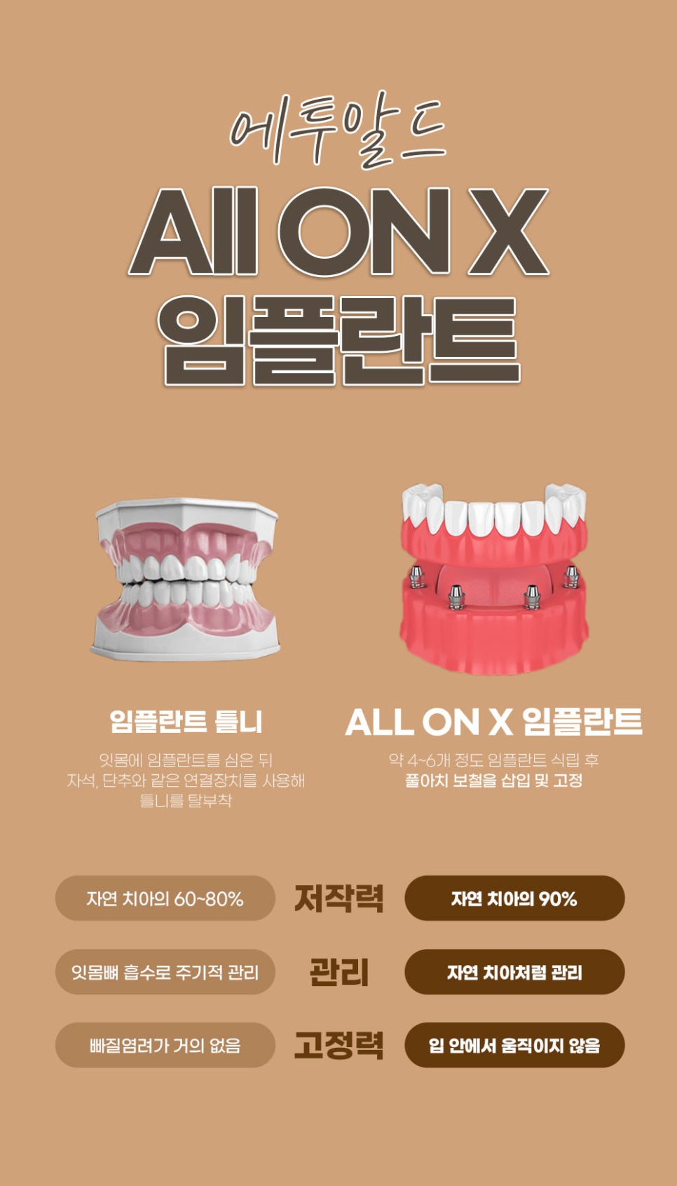 풀아치임플란트 정품 치과를 확인해야해요! 임플란트 하실 분 주목!! 관련 이미지 5