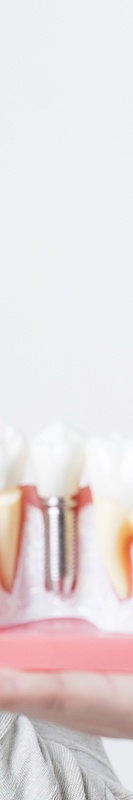 네비게이션임플란트가격 부담을 덜 수 있는 방법 관련 이미지 26