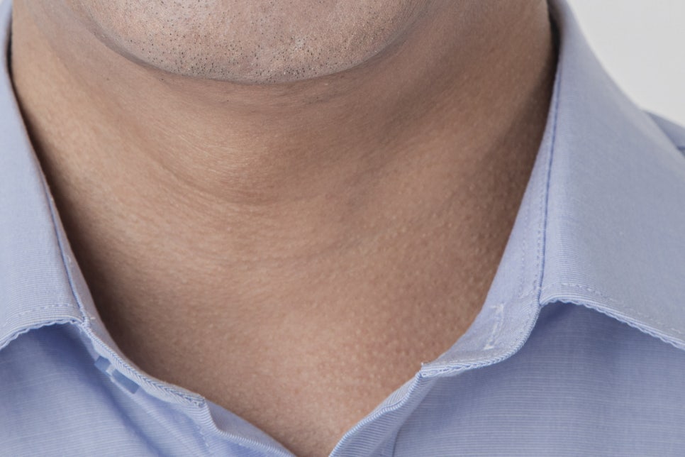 강남구 임플란트 세 가지 체크하고 결정하자! 관련 이미지 14