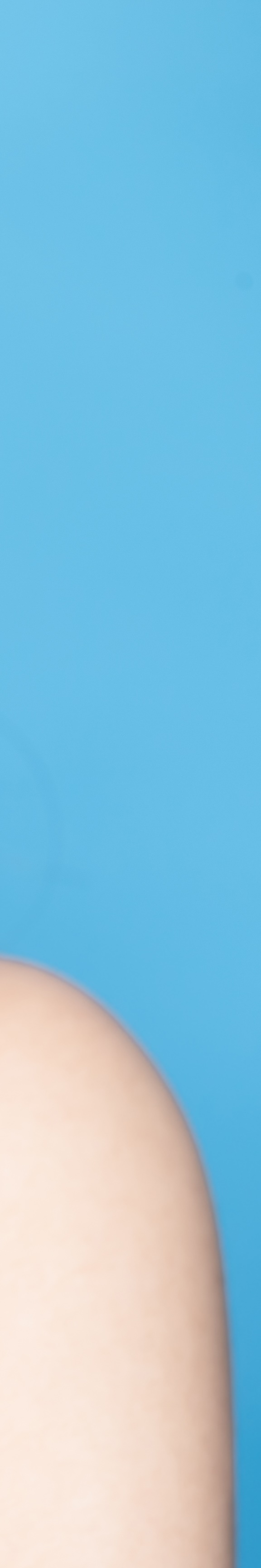 신사동임플란트 건강한 치아로 돌아가는 첫걸음 관련 이미지 21