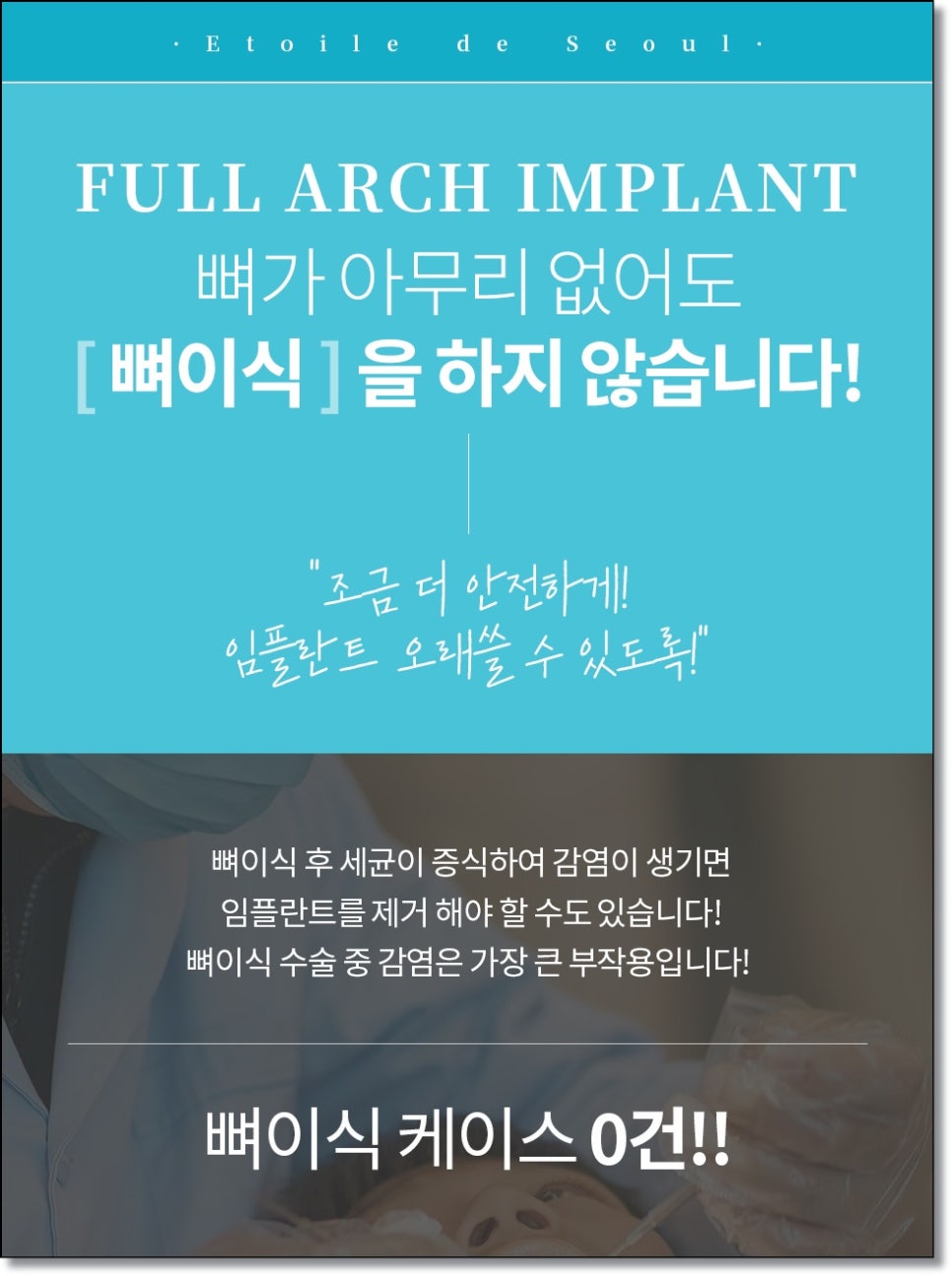 풀아치 임플란트 관리도 자연치아처럼 하면 될까요? 관련 이미지 8