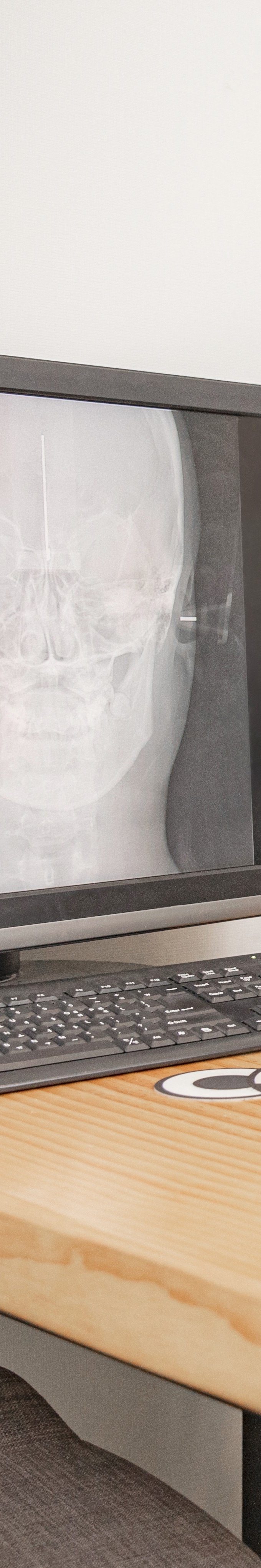 Understand the Side Effects of Maxillary Sinus Lifting Thoroughly and Respond Wisely image 19