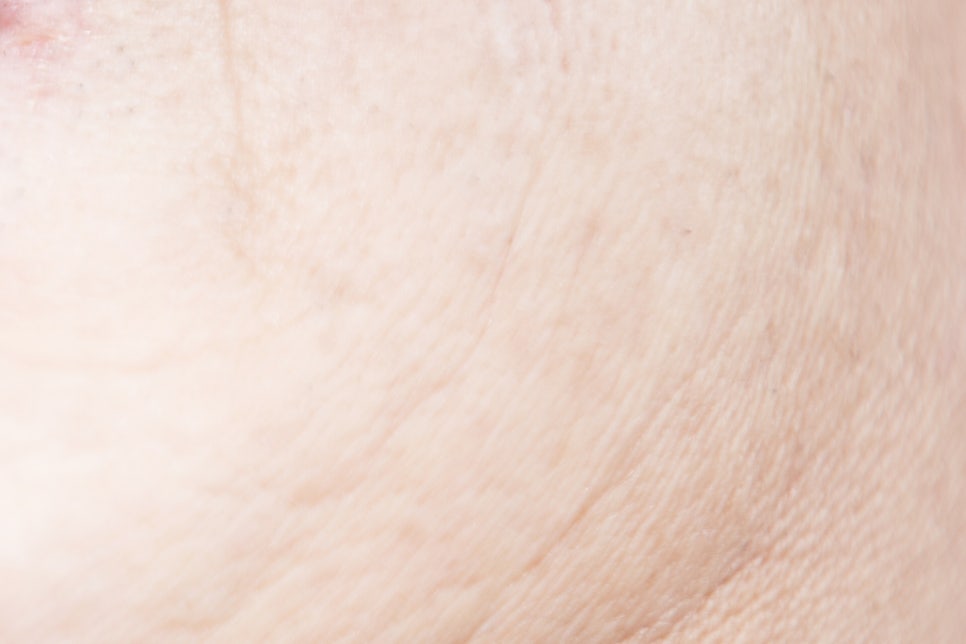 청담동 임플란트 불편함을 줄인 방법 관련 이미지 23