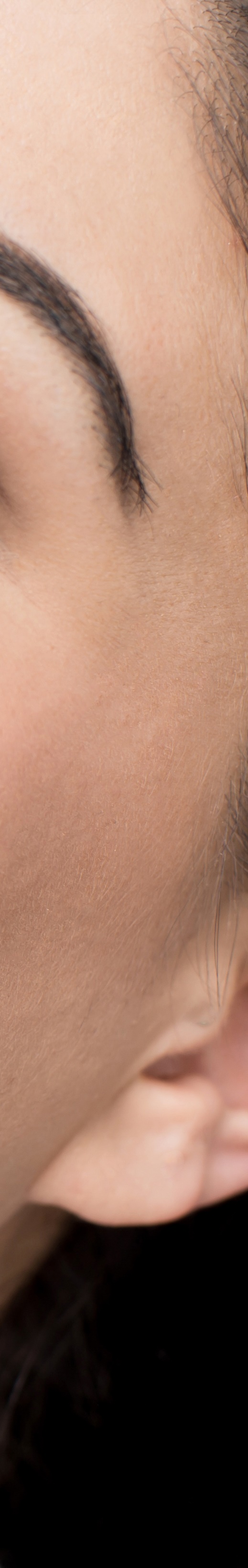 올온엑스 무치악이라도 걱정없이 치료 관련 이미지 33