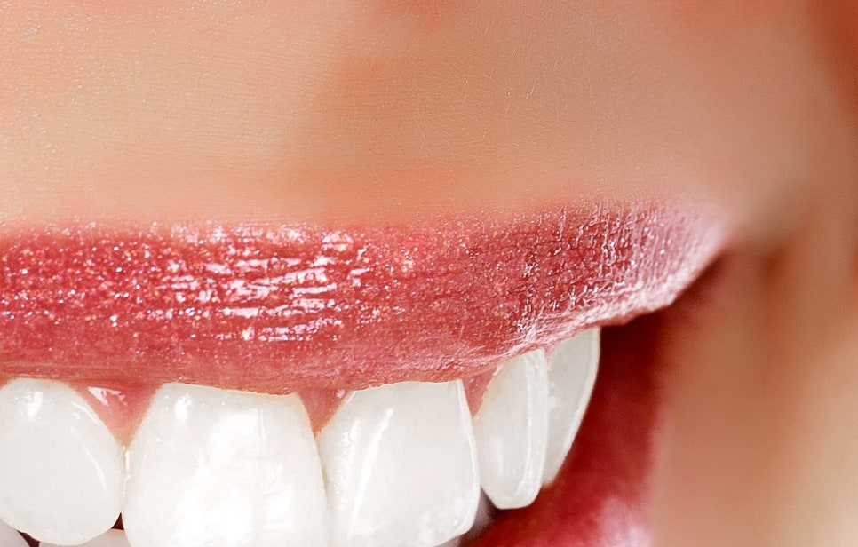 풀아치 임플란트 무치악으로 고생한다면? 관련 이미지 19