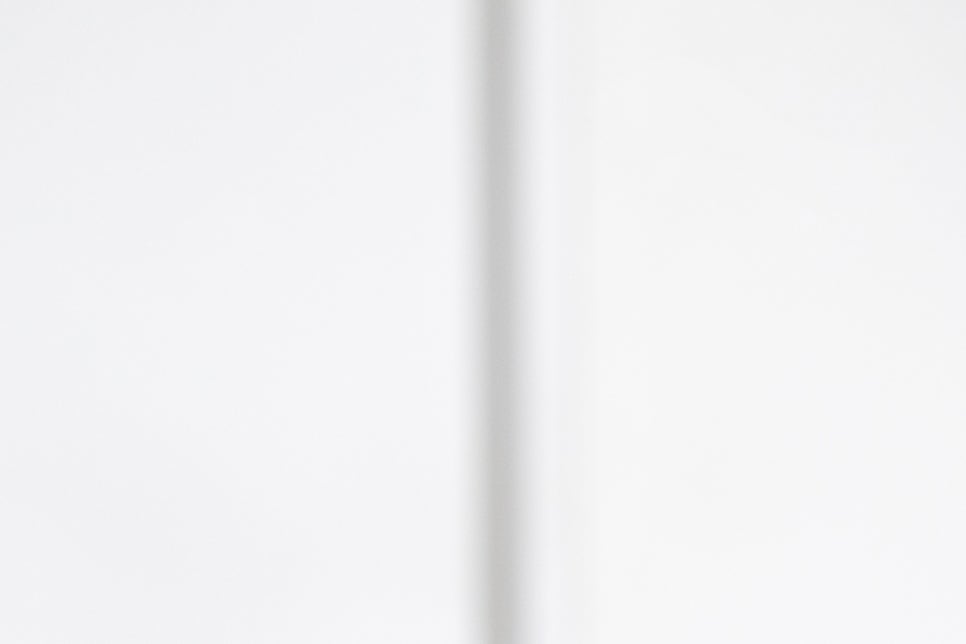 강남 풀아치임플란트 아리따운 미소를 되찾아 관련 이미지 20