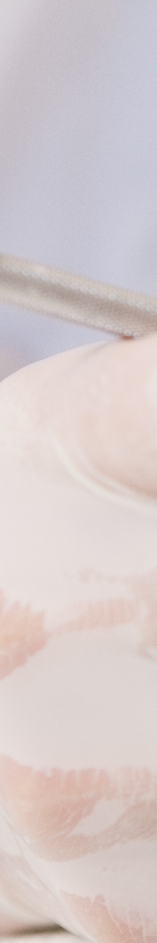 최소 삭제 라미네이트 치아를 지키며 아름다움 더하기 관련 이미지 24